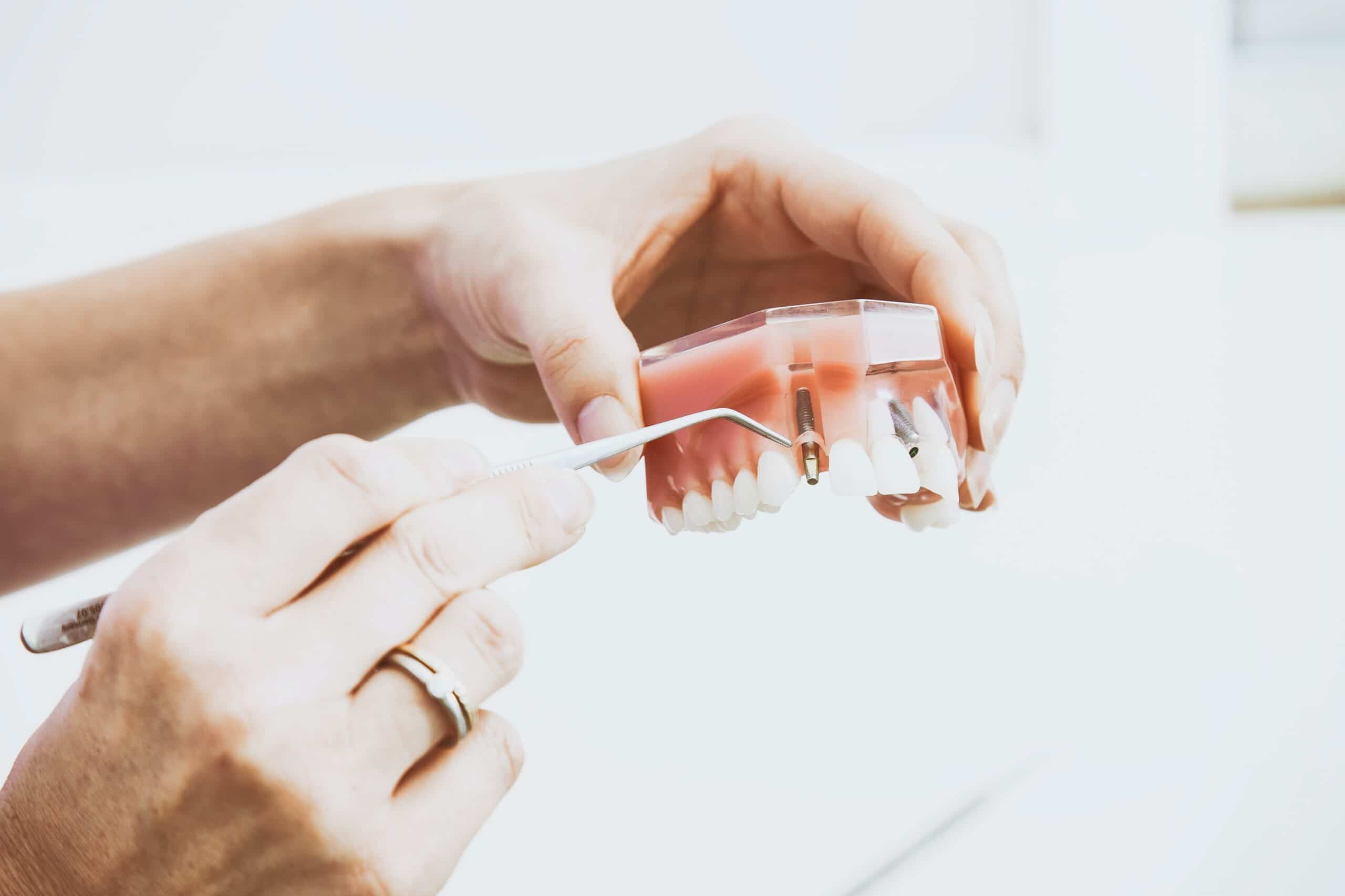 Terapia endodontica